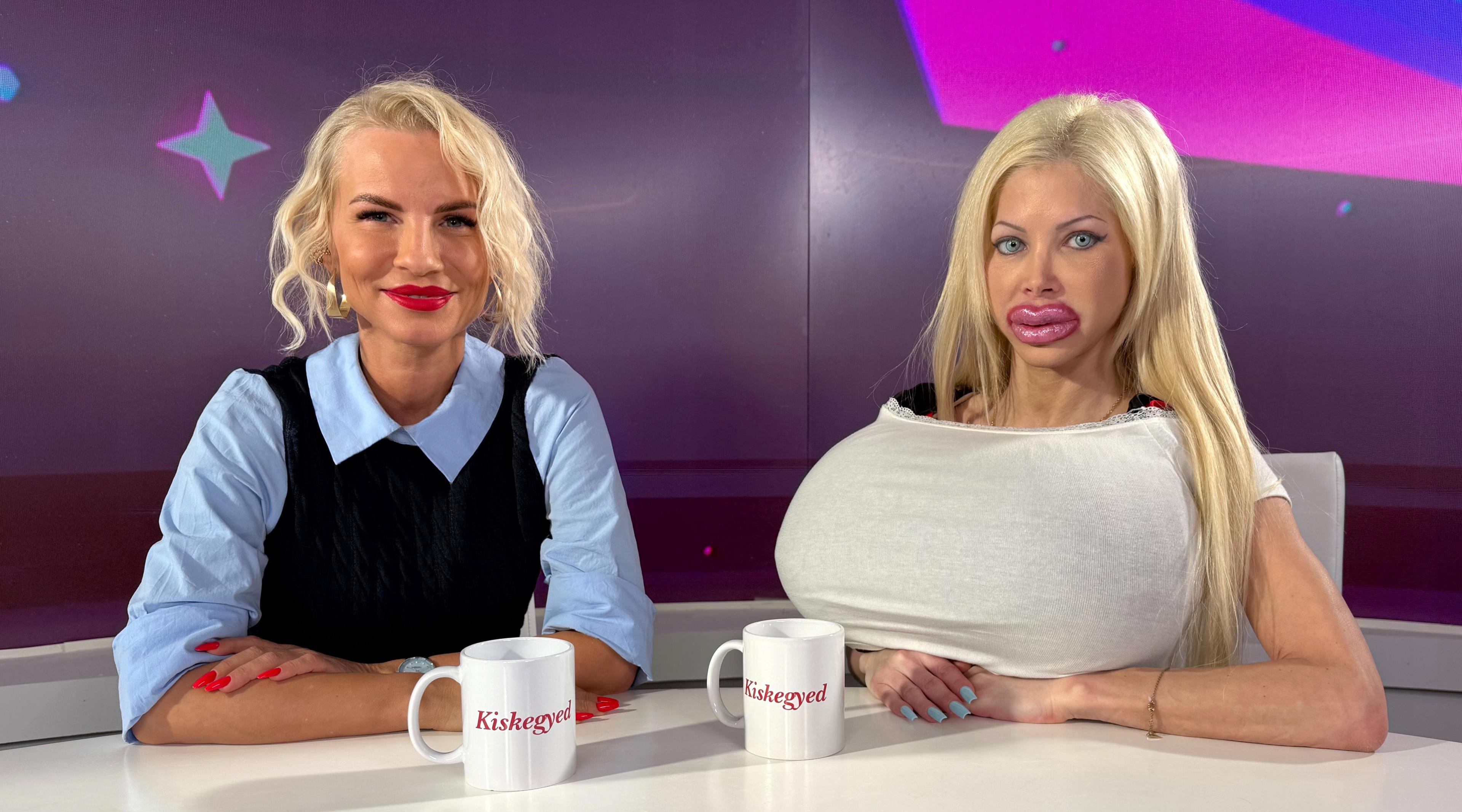 Thumbnail for Az életével játszik? Baj Angelika: "Ezek a mellek mindent megérnek"